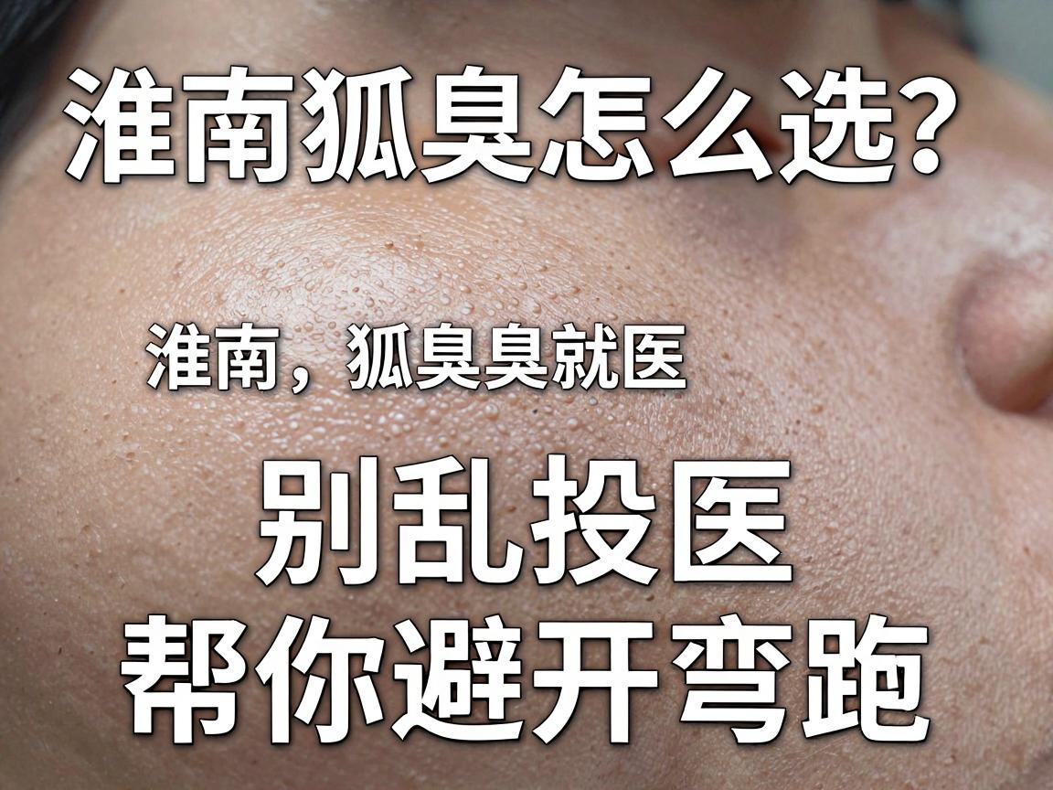 淮南狐臭医院怎么选?别乱投医,这份淮南狐臭就医指南帮你避开弯路 淮南狐臭医院怎么选?别乱投医,这份淮南狐臭就医指南帮你避开弯路